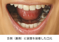 㑤iKE)