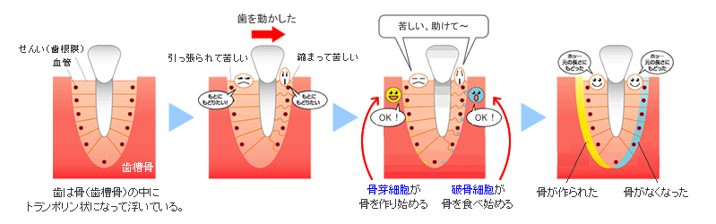 歯が動く仕組み（矯正歯科の豆知識） - 東大阪市の歯列矯正 大阪アート矯正歯科