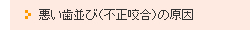 悪い歯並び（不正咬合）の原因