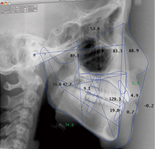 Cephalometrics A to Z@C[W